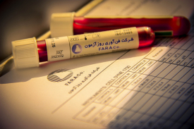 خون کنترل
