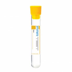 لوله لخته سرم (حاوی Gel & Clot Activator )